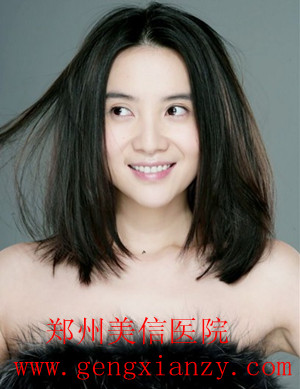 闭经