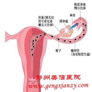 输卵管炎